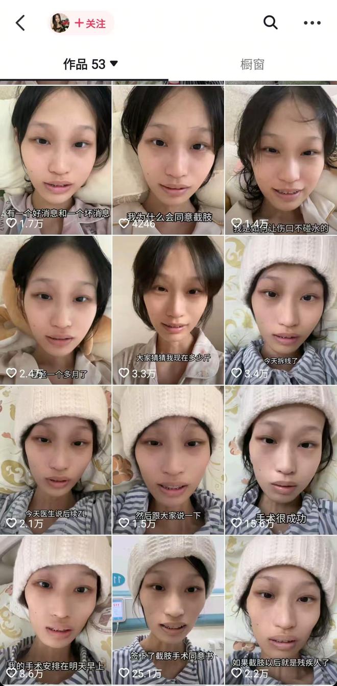 太揪心！21岁抗癌女孩饭饭病情再次恶化截肢后癌细胞又肺转移(图2)